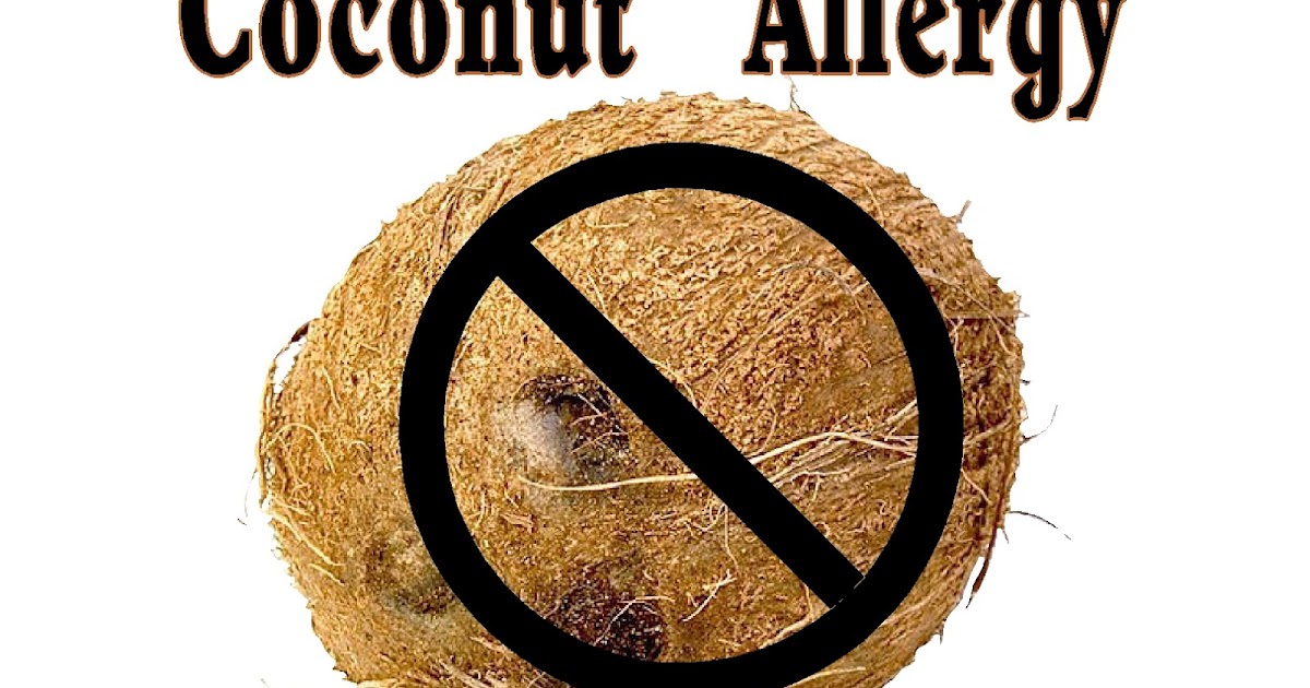 Free Posters and Signs Coconut Allergy