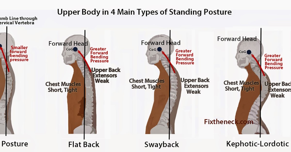 types of postures