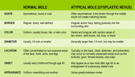 Irregular Moles Chart