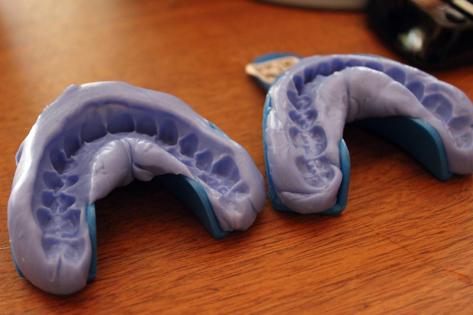 Glazed Over Beauty Smile Brilliant Customized Teeth Whitening Review