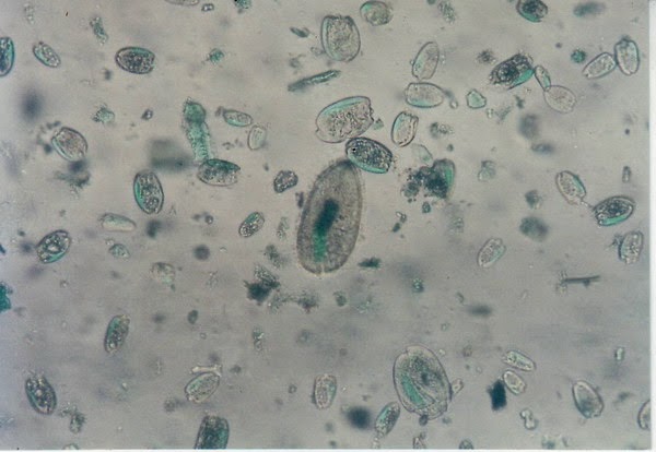 Protozoa rumen