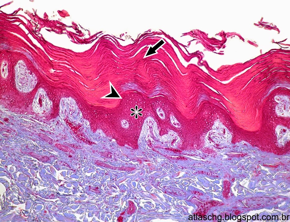 Tecido epitelial de revestimento estratificado pavimentoso queratinizado Tecido epitelial de revestimento estratificado pavimentoso queratinizado