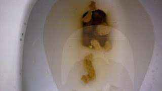 Bile acid malabsorption Yellow - Yellow Choices Bile acid malabsorption Yellow - Yellow Choices