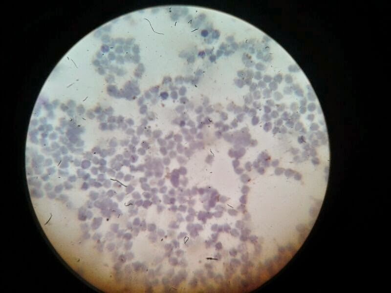 ERITROCITOS RECUENTO DE RETICULOCITOS LEUCOCITOS Y eritrocitos recuento de reticulocitos leucocitos y: