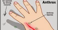 Sumbarsehat.com: PENYELIDIKAN KLB PENYAKIT ANTRAKS