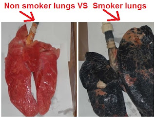 non smoker vs smoker lungs pictures and images