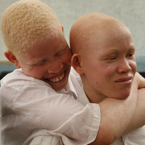 happy albino