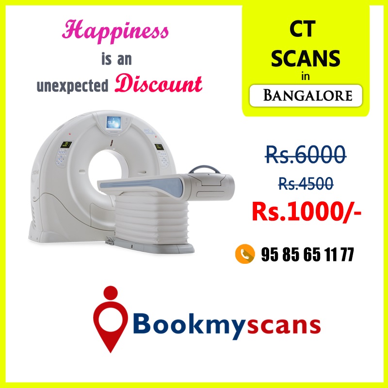 CT Scans in Bangalore