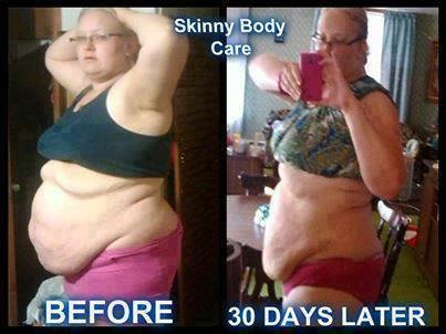 Skinny Body Care Weight Loss