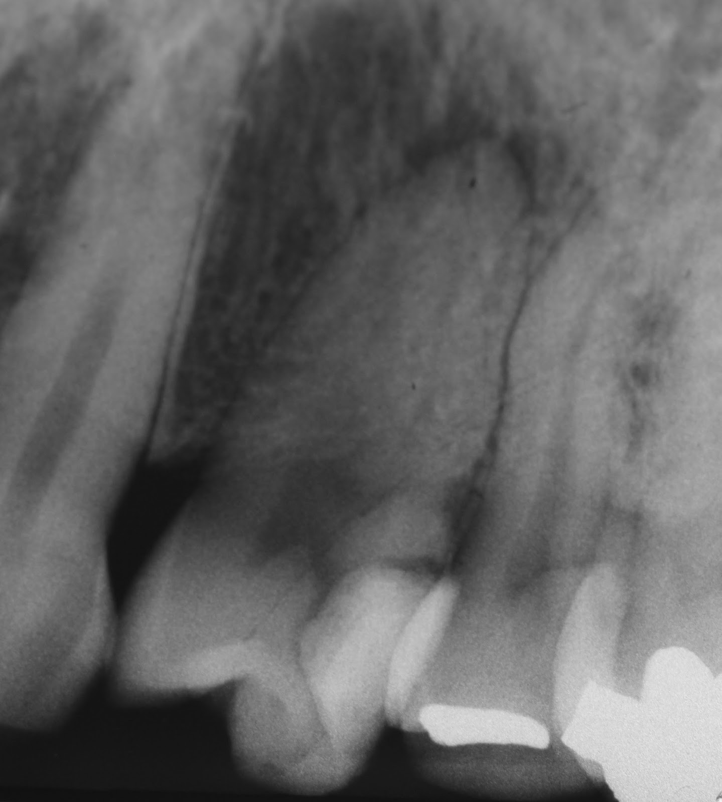 Ask DrM Warm vertical condensation