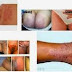 Harga Obat Anti Sipilis Ampuh thumbnail