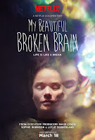 OMy Beautiful Broken Brain