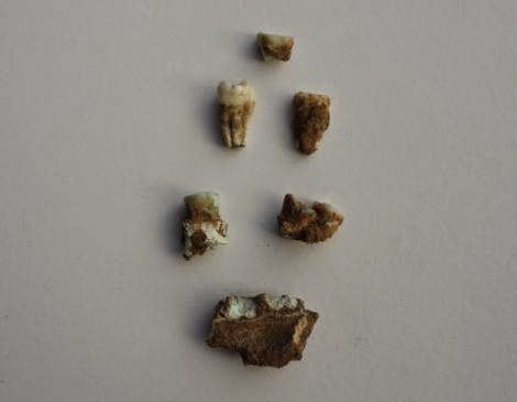 Fragments of the crown discovered in Chandayan village of Uttar Pradesh's Baghpat district [Credit: Times of India]