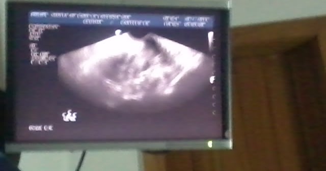 Exame de ultrassonografia abdominal total