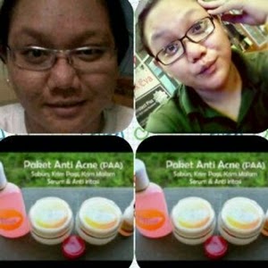 Bukti dan Testimoni Cream Pemutih Wajah Florin Skin Care Paket Normal Bukti dan Testimoni Cream Pemutih Wajah Florin Skin Care Paket Normal
