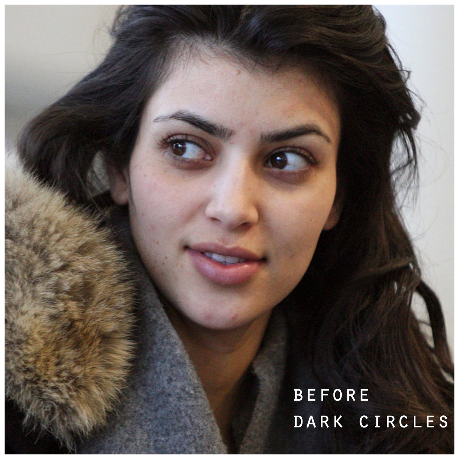 DarkCircles.png