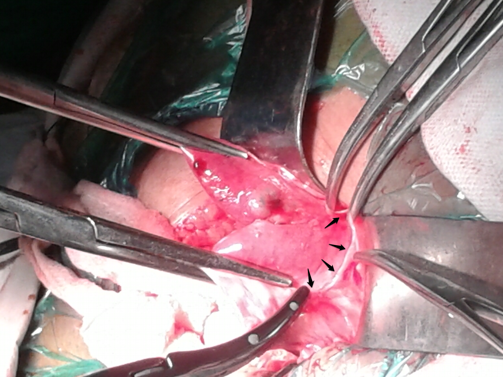 Journal of Postgraduate Gynecology & Obstetrics Journal of Postgraduate Gynecology & Obstetrics
