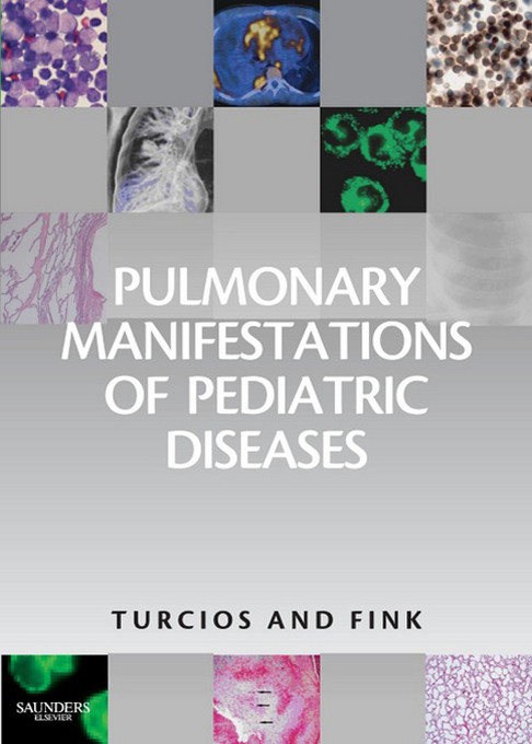 Pulmonary Manifestations of Pediatric Diseases, 1e 