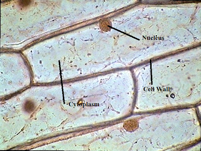 red onion cell lab essay The mcgill physiology virtual lab blood red cell fragility osmotic hemolysis : cell membranes are semipermeable barriers, (hemolysis) which dissolves in. red onion cell lab essay The mcgill physiology virtual lab blood red cell fragility osmotic hemolysis : cell membranes are semipermeable barriers, (hemolysis) which dissolves in.