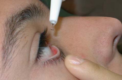 Instilación de un colirio