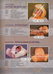 PANTOM INJEKSI (IM), PANTOM PERSALINAN MODEL ELEKTRIK