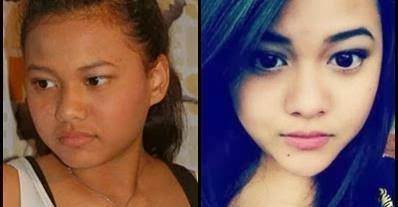 Aurel Perubahan Wajah Artis Korea