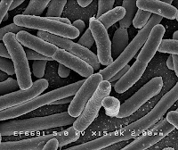  yakni kelompok organisme yang tidak mempunyai membran inti sel Nih Sejarah Penemuan Bakteri
