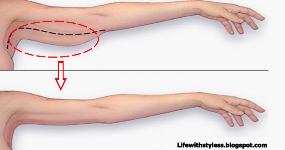 30 Minutes Exercises to Lose Arm Fat in 1 Week at Home (No Equipment Required) Life With Styles