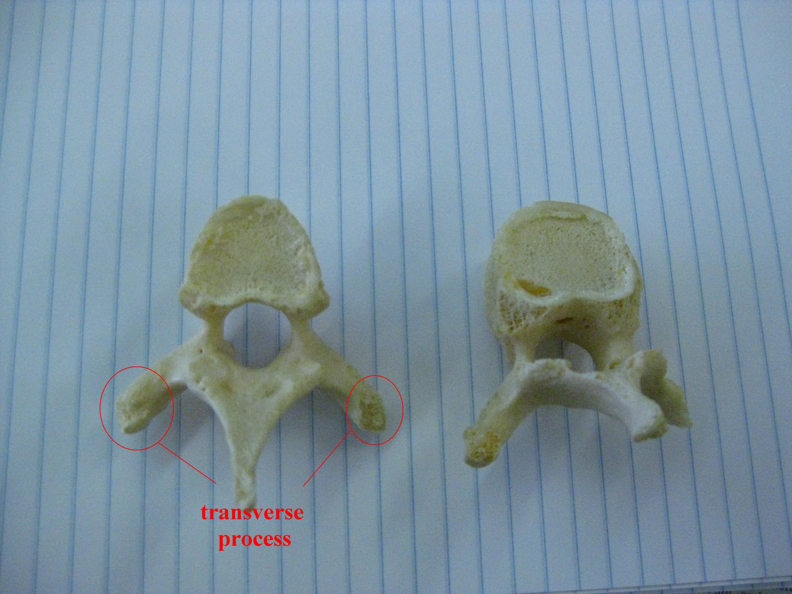 Boned: Human Skeleton - spine (vertebrae)
