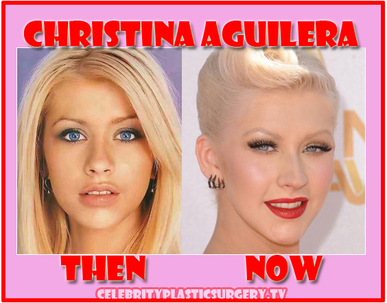 Christina Aguilera Plastic Surgery After and Before Nose Job, Botox Injecti...