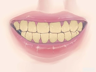 mal de dent après traitement de canal