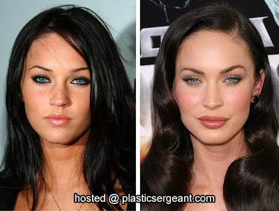 Megan Fox plastic surgery