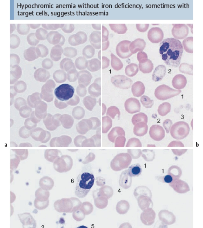 color atlas of hematology practical microscopic and clinical diagnosis pdf