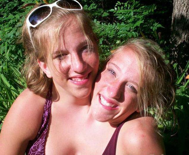 Years after these Siamese twins were born, they shared shocking news Wow!  Who would've thought? Siamese twins Abby and Brittany Hensel became  worldwide news after being born in 1990. It's not often