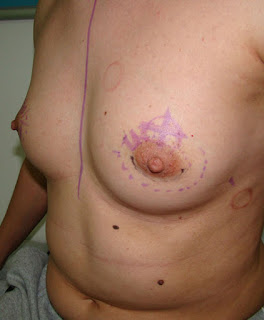 Appearance before surgery
