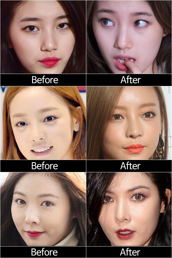 Dispatch compares Hyuna, Hara, and Suzy before and after