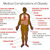 The Evolution of Obesity