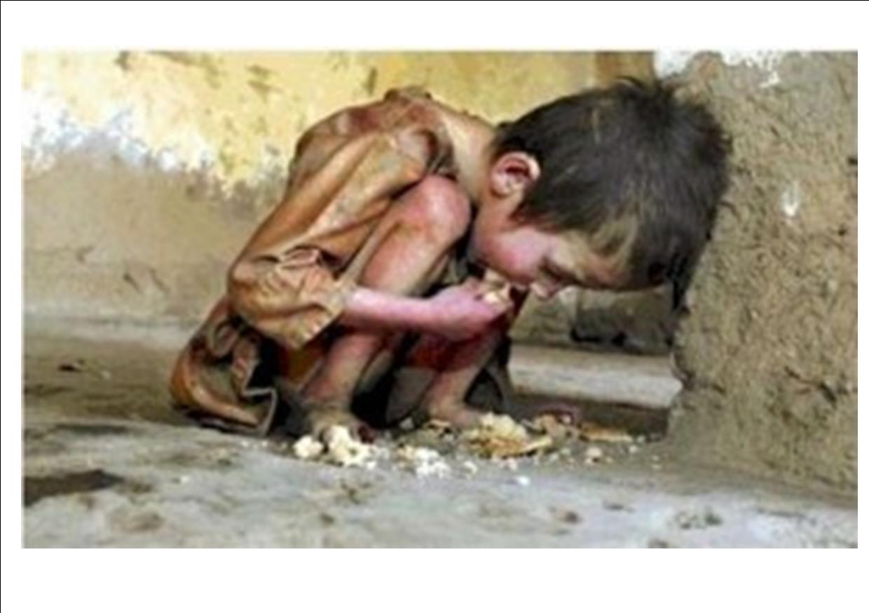 0peration Stop World Hunger