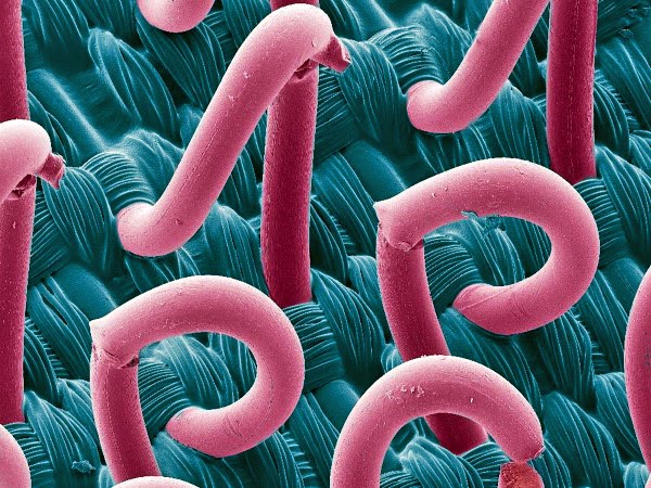 Gerrys Blog Die Welt Unter Dem Mikroskop