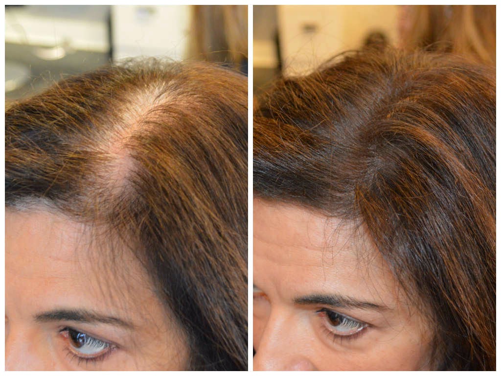Hair Loss Clinic