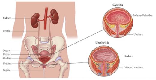 Intrapartal Hypertension Nursing.