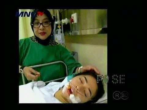 Nikita Willy Operasi Gigi Nikita Willy Operasi Gigi