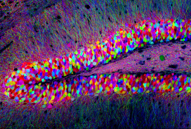 Hippocampus brainbow
by Tamily Weissman, Harvard University