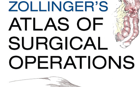 Zollinger Atlas Quy trình phẫu thuật 9e