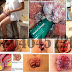 Ambeclear Obat Wasir Apa di Jual di Apotik Umum thumbnail