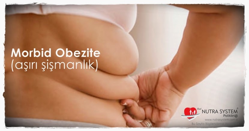 MORPİD OBEZİTE (AŞIRI ŞİŞMANLIK)
