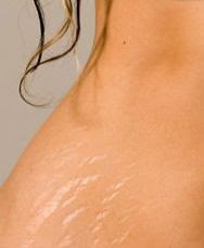 نقره لتكبير أو تصغير الصورة ونقرتين لعرض الصورة في صفحة مستقلة بحجمها الطبيعي