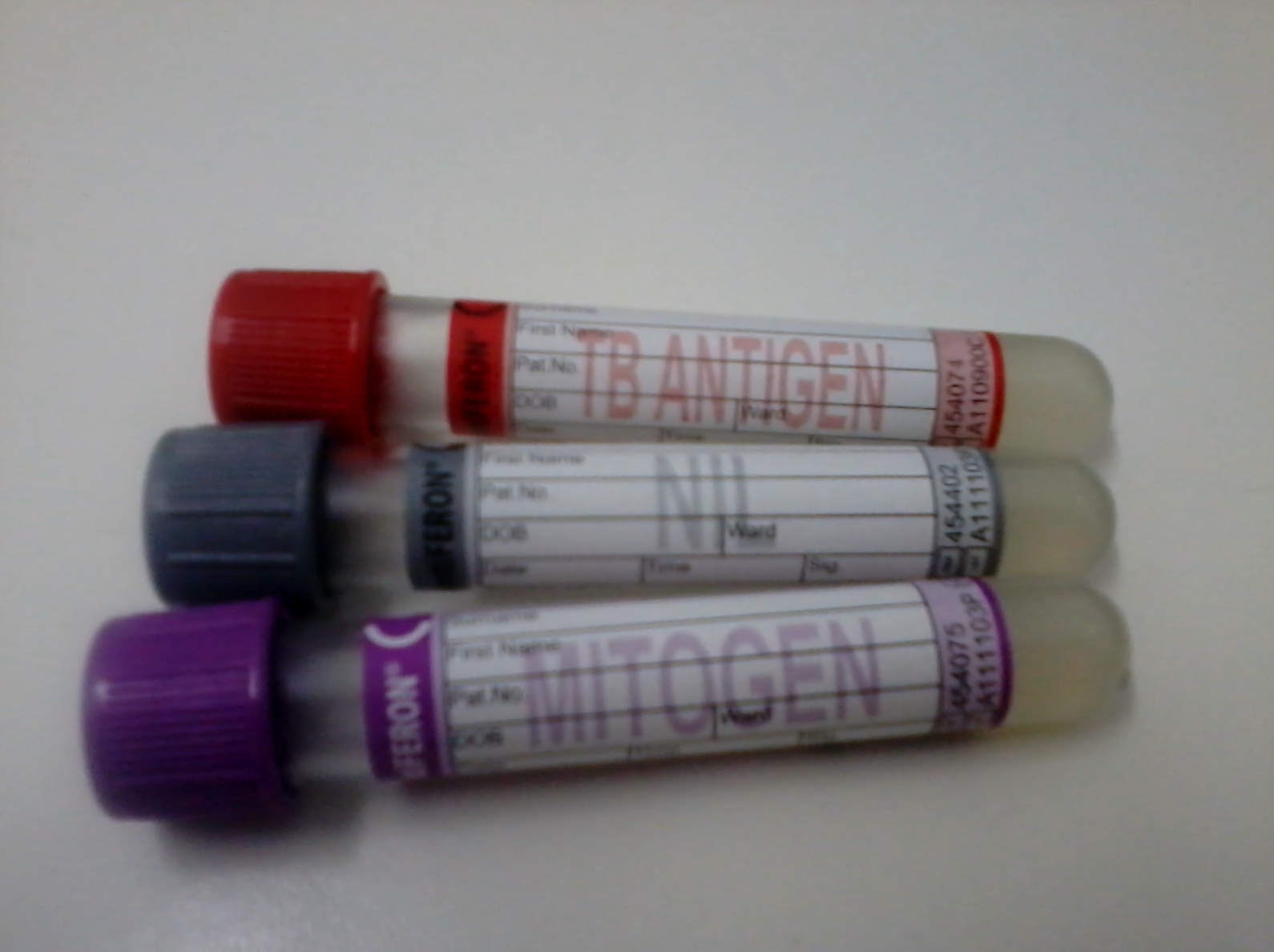 BioTrabalho Quantiferon TB Gold