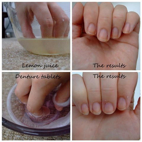 Nail whitening - denture tablets verses lemon juice