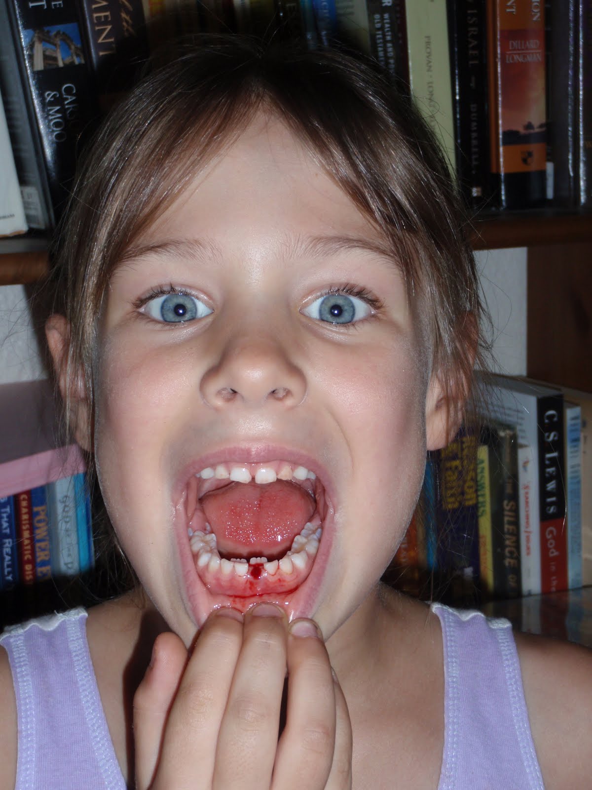 first tooth out